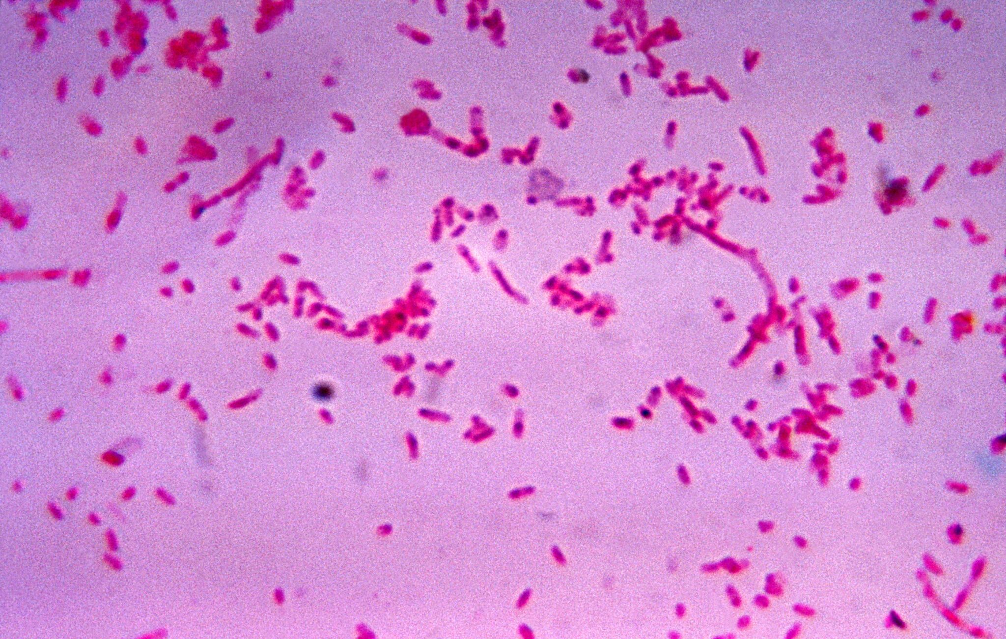 il-fusobacterium-nucleatum-induce-la-proliferazione-e-la-migrazione